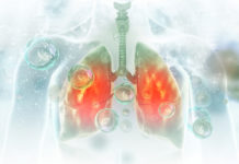 Инфекция со шрамом: как защититься от пневмонии