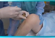 Программа «Жить здорово» от 18.05.2022: Служба боли. Теперь действовать будем мы