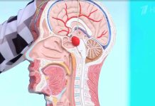 Программа «Жить здорово» от 06.06.23: Сенсация! Новый метод в лечении аневризм