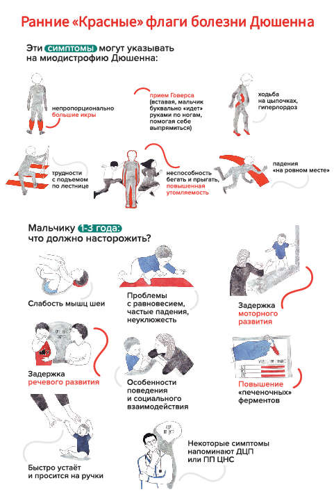 Мышечная дистрофия дюшенна псевдогипертрофия икроножных мышц. Миодистрофия дюшенна болезнь. Мышечная миопатия дюшенна. Болезнь дюшенна это что симптомы. Миодистрофия дюшенна болезнь.