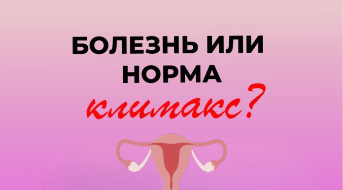 Климакс — это норма или болезнь?