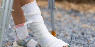 Можно ли мыться и мочить гипс при переломах